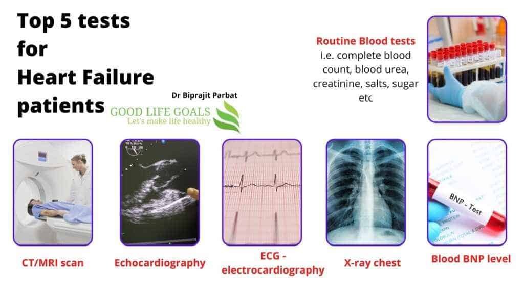 heart failure diagnosis