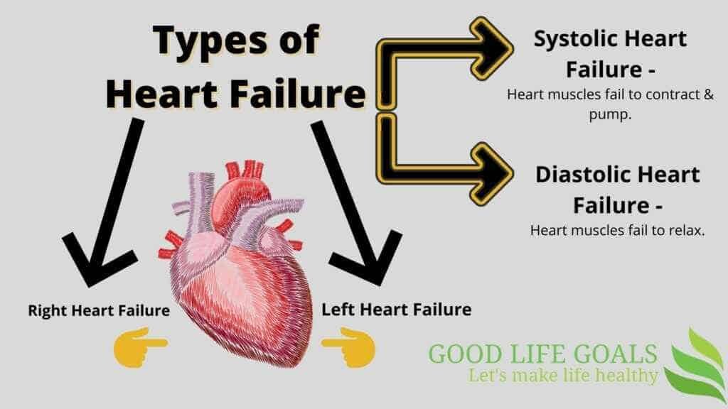 types of heart failure