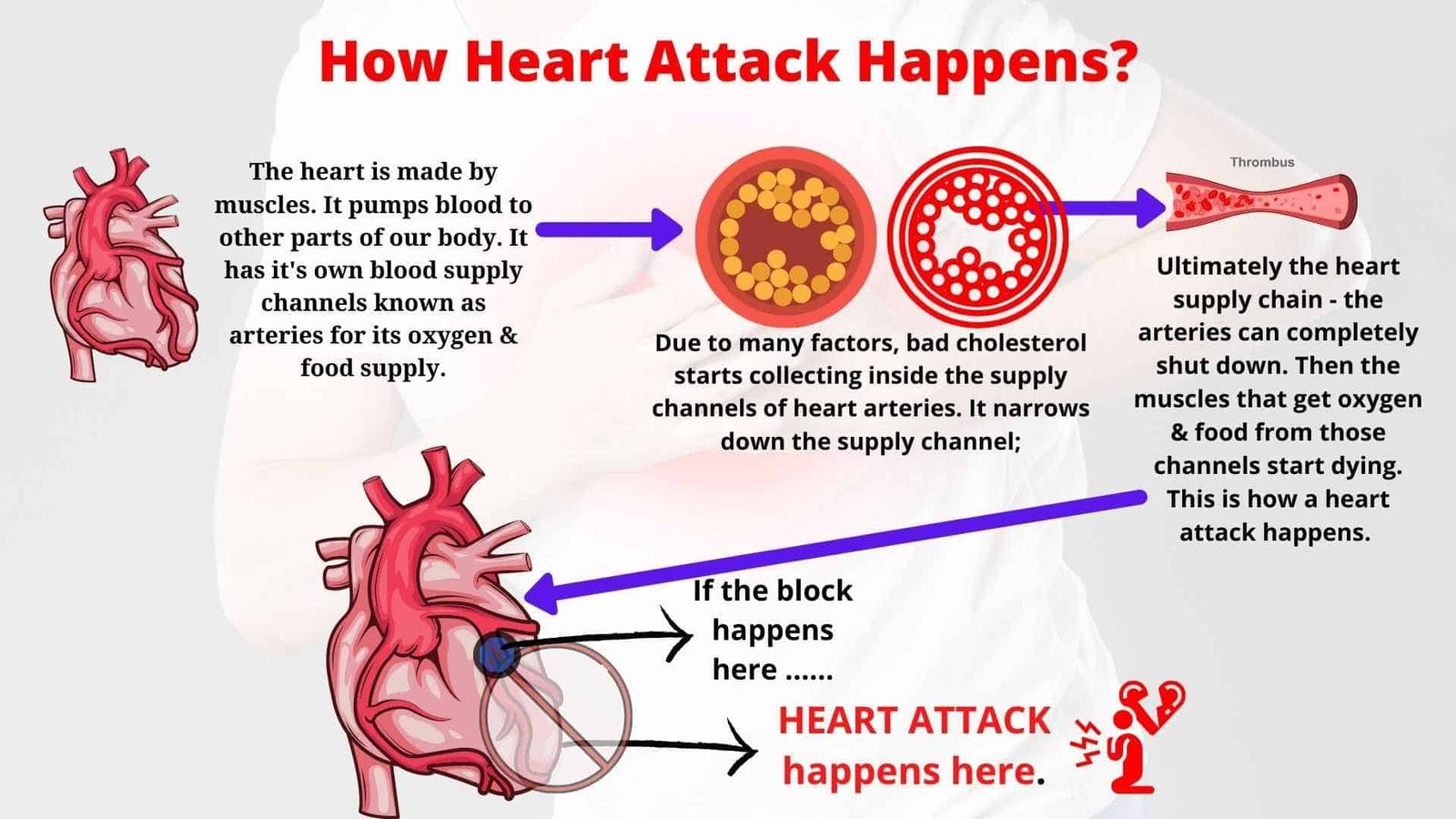 how-heart-attack-happens-dr-biprajit-parbat