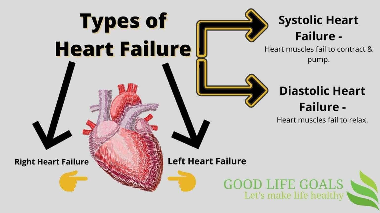 Heart Failure Types, Symptoms, Diagnosis And Treatment – A 